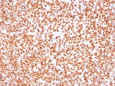 Formalin-fixed, paraffin embedded human tonsil sections stained with 100 ul anti-Oct-2 (clone OCT2/2137) at 1:300. HIER epitope retrieval prior to staining was performed in 10mM Citrate, pH 6.0.